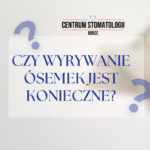 Czy wyrywanie ósemek jest konieczne?