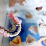 Protetyka w praktyce: jak odbudowujemy uśmiech w Bibicach — korony, mosty i protezy